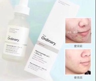 30ml The Ordinary 10%煙酰胺 +1%控油精華