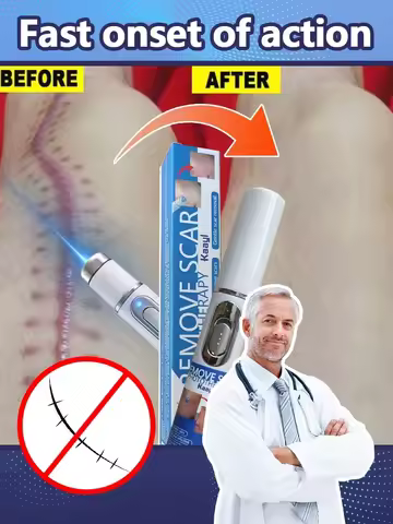 Laser therapy Keloid scar