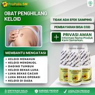 Obat Keloid Daging Tumbuh Penghilang Keloid Luka Tindik Di Telinga Keloid Menonjol di Dada Keloid Be