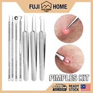 🏠READY STOCK🏠4pc Set Pimple Kit Set Besi Picit Jerawat Stainless Steel Acne Blackhead Removal Needle