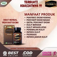 Obat Eksim Kering Basah Eksim Menahun  Gatal Menahun  Kulit Bersisik Menebal Psoriasis Kurap Proskin