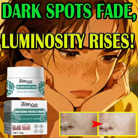 EELHOE Nicotinamide Freckles Cream Melasma Remover Pigmentation Removal Cream Whitening Freckle Crea