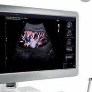 monitor usg samsung medison accuvix A30