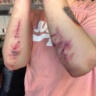 Halloween Tattoo Sticker Fake Scar Simulation Scar Halloween Party Makeup Bar Fake Wound Sticker