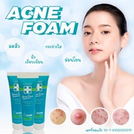 CERAMINE ACNE FOAM เซอรามายน์ แอคเน่ โฟม [50 g, 100 g] – โฟมล้างหน้า ◆ คุมความมัน ยับยั้งและลดสิว ◆ 