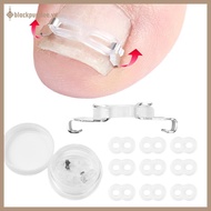 BPURPLE 1/2 Set Ingrown Toenail Corrector Tools Pedicure Recover Embed Toenail Treatment Professiona