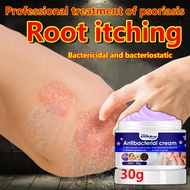 ⚡️quick anti-itch⚡️eczema treatment cream for allergy itchy skin eczema 30g, Psoriasis Treatment Cre