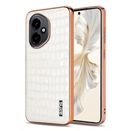 Crocodile PU leather back case for HONOR 400 Pro X70 X60 Magic 7 slim cover HONOR400 400Pro X60Pro M