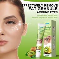 krim milia seed remover vitamin E eye milia cream fat granule syringoma milia remover eye health car