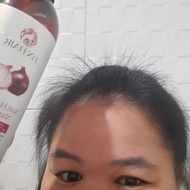 แชมพูหอมแดงฟินแฮ แชมพูสำหรับผู้มีผมร่วงผมบางโดยเฉพาะ Finhair Anti Hair Loss Shampoo บริการขนส่งโดยKerryค่ะ มั่นใจได้ว่ารวดเร็วว่องไวแน่นอน#แชมพูหัวหอม #ลดผมร่วง #แชมพูเร่งผมยาว #เร่งผมงอกใหม่ #แชมพูหอมแดง #ฟินแฮ