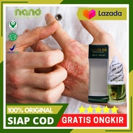 Obat Gatal Exim Kering Menahun Obat Eksim Basah Obat Alergi Kulit Obat Gatal-Gatal Kulit Kering Ruam