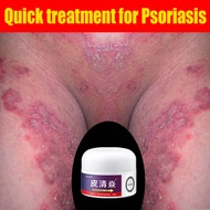 Itchy Skin Cream Itching Of Inner Thigh Anti-Itch Psoriasis Eczema Itch Relief Fungus Ointment Hand Foot Skin Problems