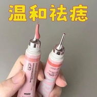 Do Not Leave Marks Remove Moles Cream for Whole Body Use 9.9