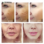 5 Seconds Instant Wrinkle Remover Face Cream Eye Firming Ant