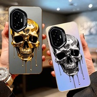 tengkorak IMD casing for HONOR X9C SMART/HONOR X9B/HONOR X9C/HONOR X9D/HONOR X7C/HONOR X7D/HONOR X6C