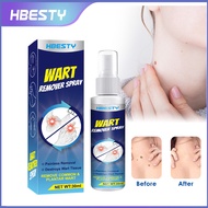 【Ready stock】H HBESTY Wart Removal Spray Wart Smoothing Treatment Liquid Corn Flesh Care Liquid LMm9