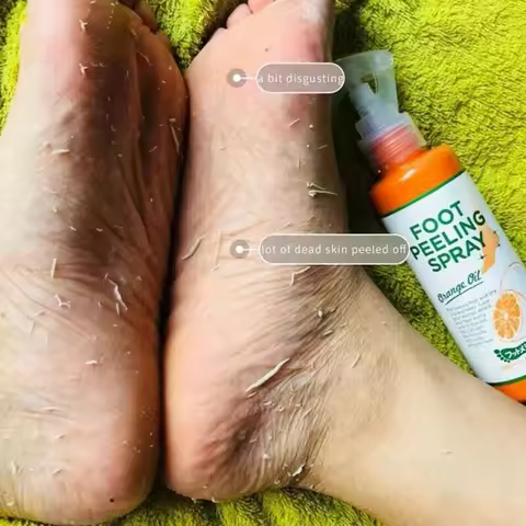 100ml Foot Care Spray Remove Dead Foot Exfoliator Softener Gently Cares Foot Skin Moisturizes Hydrat