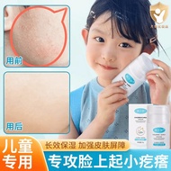 Vie Urea Urea Cream Children's Face Ups Small Goosebumps with Small Particles Chicken Skin Hair Foll