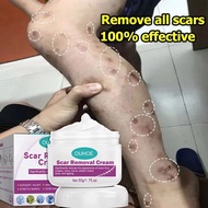 krim hilangkan parut hitam Hilangkan parut kaki Hilangkan bekas luka lama Hilangkan parut kudis Mosq