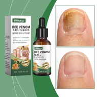 South Moon Bee Venom Nail Fungus Care Solution Repair Nourishing NailSoft and Thick Nails Nail Nouri