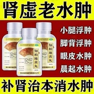 Kidney Yin Deficiency Edema, Calf Swelling Eyelid Instep Ede Kidney Vaginal Edema Calf Floating Edem