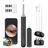 Bebird X17 Pro Ear Wax Removal, Bebird Ear Cleaning Tool, Ear Cleaner Earwax Removal Kit Ear Cleaner