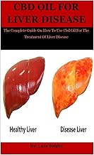 Cbd Oil For Liver Disease: The Complete Guide On How To Use Cbd Oil For The Treatment Of Liver Disea