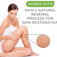 Amlactin 12% Alpha Hydroxy Acid Body Lotion - Moisturizing and Hydrating