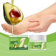 Ximonth Shea Butter Olive Oil Moisturizing Cream Used For Heel Care Deeply Moisturizing And Nourishi
