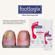 [ Ready stock ] FOOTLOGIX Nail Tinture Anti- Fungal spray kuku kulat