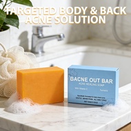 Bacne Out Bar Soap with Turmeric, Vitamin C & AlphaArbutin, Natural Body Acne Treatment for Back, Ch