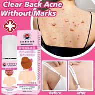 Back Acne Spray 60ML body acne acne scar removal Back Acne Repair Spray Acne Mark Removal Pimple Sca