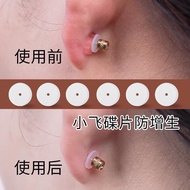 【00118cjv4wi34.my】 防增生小飞碟医用耳洞修复垫片硅胶飞盘肚脐钉耳钉唇钉舌钉防内陷Anti proliferation small flying saucer medical ear 