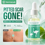 Scar Removal Cream 30ml Emu Renew Serum Muka Acne Spot Treatment For Dark Spots And Restores Acne Cr