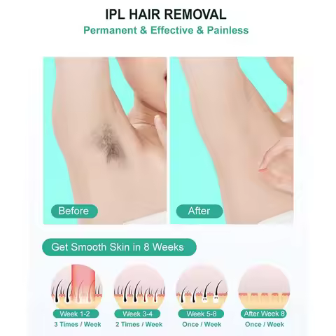 BAAN-For Women Men,999, 999 Flashes Laser Hair Removal Device At-Home Permanent Hair Removal On Faci