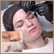 Comedone Extractor Tool Pimple Popper Tool Kit Stainless Multipurpose Whitehead Extractor Tool With 