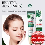 20g Tea Tree Gel Fades Acne Controls Oil Cleanses Skin Oil Pimples And Controls B6d7