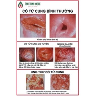 Painting of the cervical is normal and cervical cancer. Beauty cosmetic spa painting. Glossy decal p