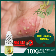 Obat Scabies Manusia Alami Obat Kutu Scabies Obat Gatal Scabies Pada Anak Obat Kudis Scabies Salep S