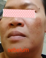 Krim jeragat by PR COSMETIC ( kkm product NOT 210404008K)