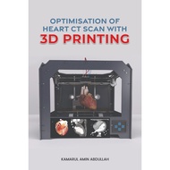 Optimisation Of Heart CT Scan With 3D Printing