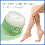 ❃ ∞ ◈ SEFUDUN Varicose Vein Treatment Cream Spider Vein Pain Varicosity