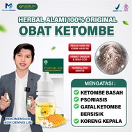 [ANTI DANDRUFF] PROPOLIS SM Dandruff Medicine for Crusty Scalp, Psoriasis, Seboroik, Fungus