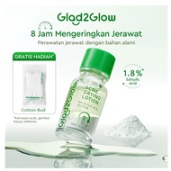 GLAD2GLOW ACNE DRYING LOTION JSELECTIV X JHON COSMETICS/ G2G ACNE Lotion/ - ORIGINAL️ BPOM