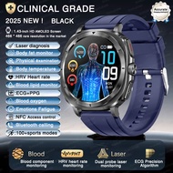 2025 New ECG+PPG Laser Monitor Health Smart Watch Men Heart Rate Uric Acid Blood fat BP Sports NFC S