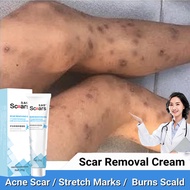 krim hilangkan parut hitam parut Hilangkan Parut kaki parut Scar Removal Cream hitam Bites Scratches