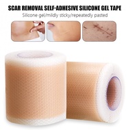 4x150cm Efficient Surgery Scar Removal Silicone Gel Sheet Therapy Patch for Acne Trauma Burn Scar Skin Repair Scar Treatment