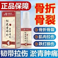 Sprain Bone Ligament Muscle Bone Spray Broken Broken Joint Pain Injured Safflower Swelling Swelling