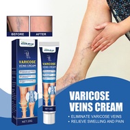Varicose Veins Relief Cream Vasculitis Phlebitis Spider Pain Relief Ointment Medical Plaster Body Care