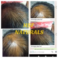 SET LENGKAP RAWATAN RAMBUT GUGUR HSF NATURAL